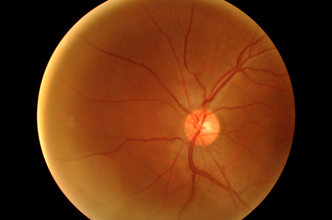 Auge_innen Privat- und Selbstzahlerpraxis